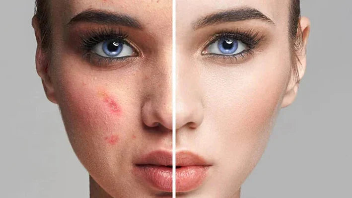 Base SkinGlow - Base mágica